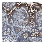 Merck Anti-MOGAT3 antibody produced in rabbit