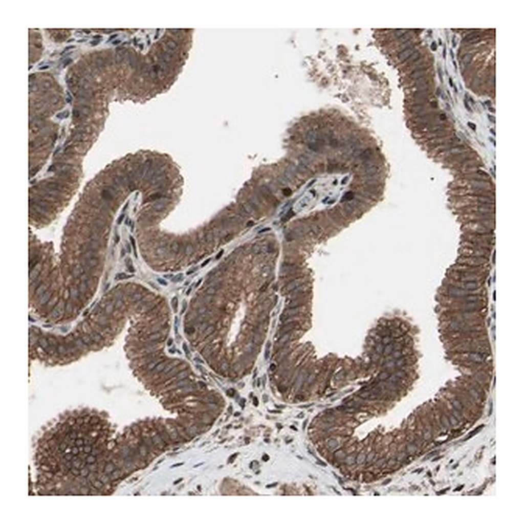 Merck Anti-TNFRSF1A antibody produced in rabbit