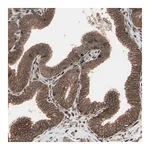 Merck Anti-TNFRSF1A antibody produced in rabbit