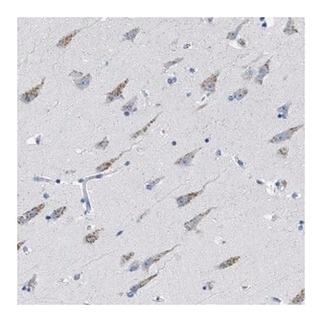 Merck Anti-WBSCR17 antibody produced in rabbit