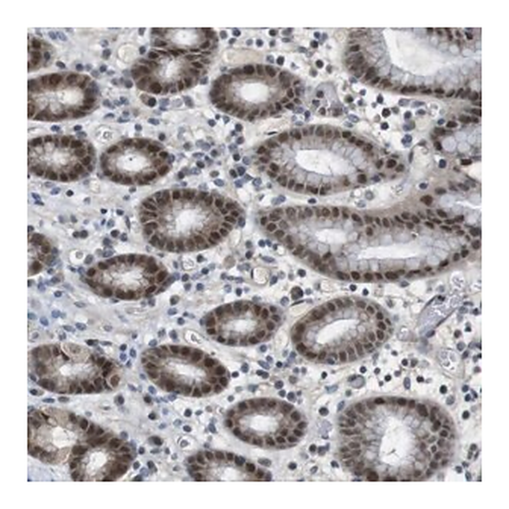 Merck Anti-MAPKAPK5 antibody produced in rabbit