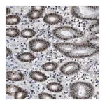 Merck Anti-MAPKAPK5 antibody produced in rabbit