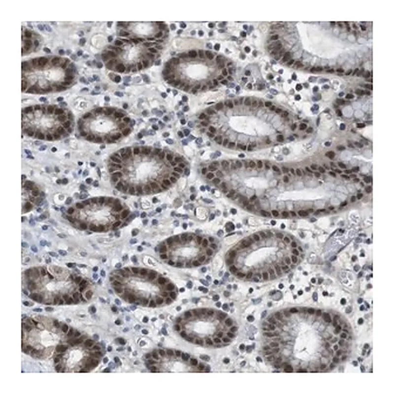 Merck Anti-MAPKAPK5 antibody produced in rabbit