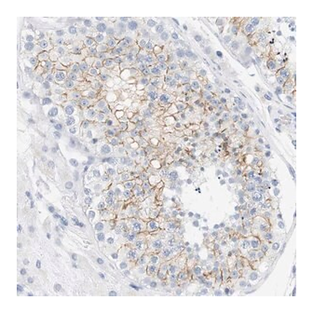 Merck Anti-OPRM1 antibody produced in rabbit