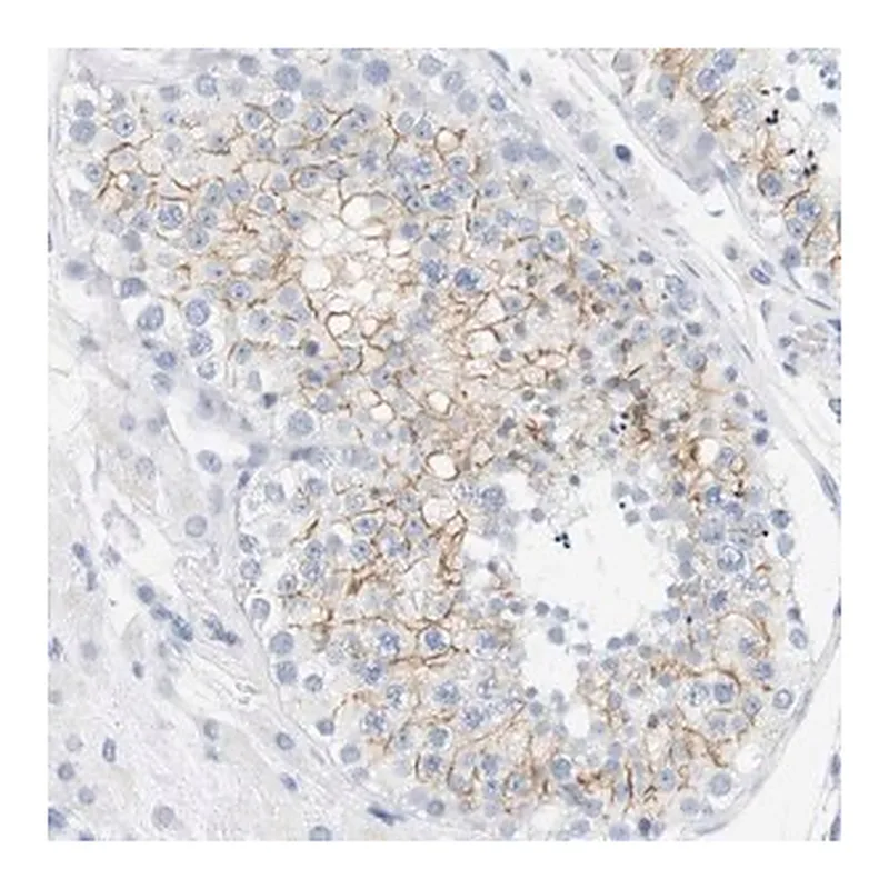 Merck Anti-OPRM1 antibody produced in rabbit
