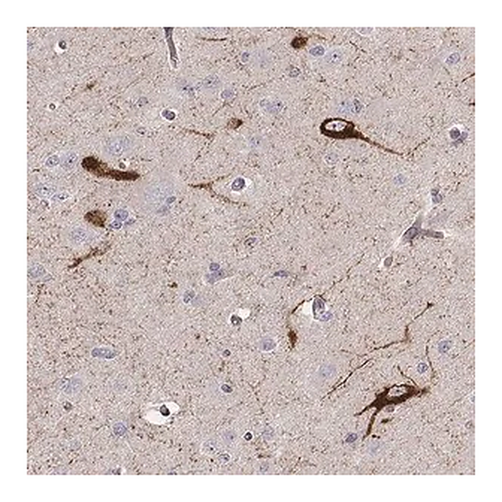 Merck Anti-TAC1 antibody produced in rabbit