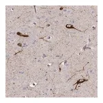 Merck Anti-TAC1 antibody produced in rabbit