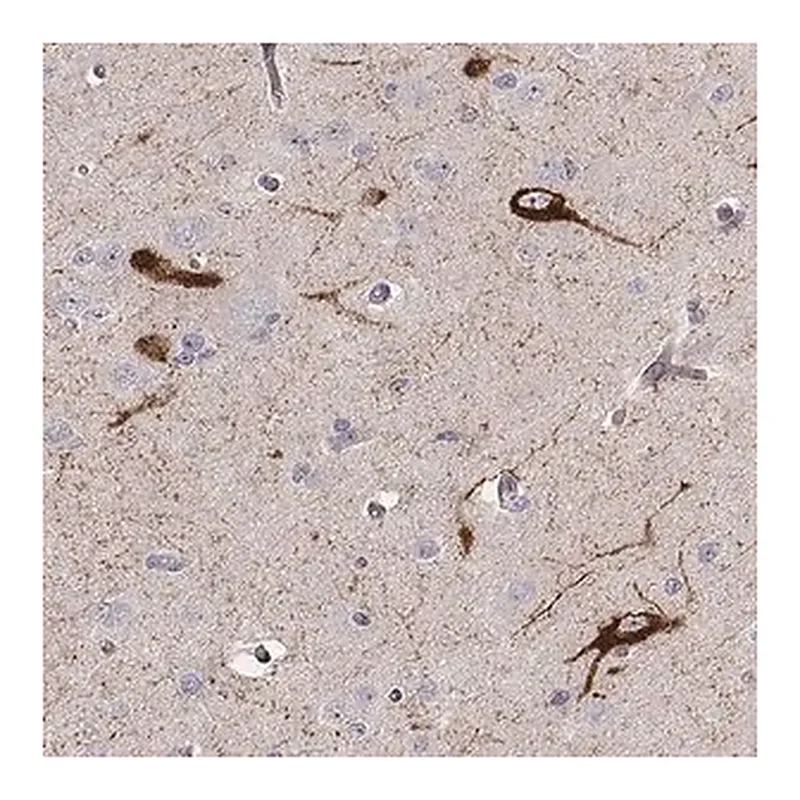 Merck Anti-TAC1 antibody produced in rabbit
