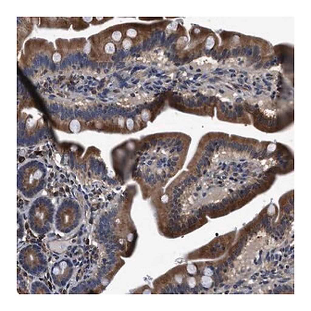 Merck Anti-DHRS7B antibody produced in rabbit