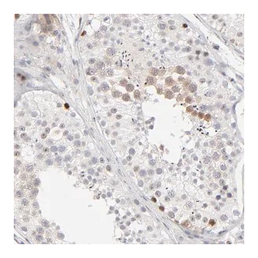 Merck Anti-AURKA antibody produced in rabbit