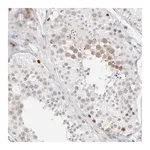 Merck Anti-AURKA antibody produced in rabbit