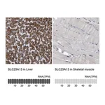 Merck Anti-SLC25A13 antibody produced in rabbit
