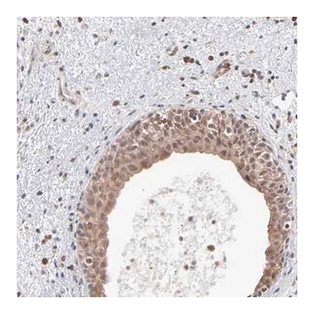 Merck Anti-OAS1 antibody produced in rabbit