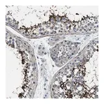 Merck Anti-DGKE antibody produced in rabbit