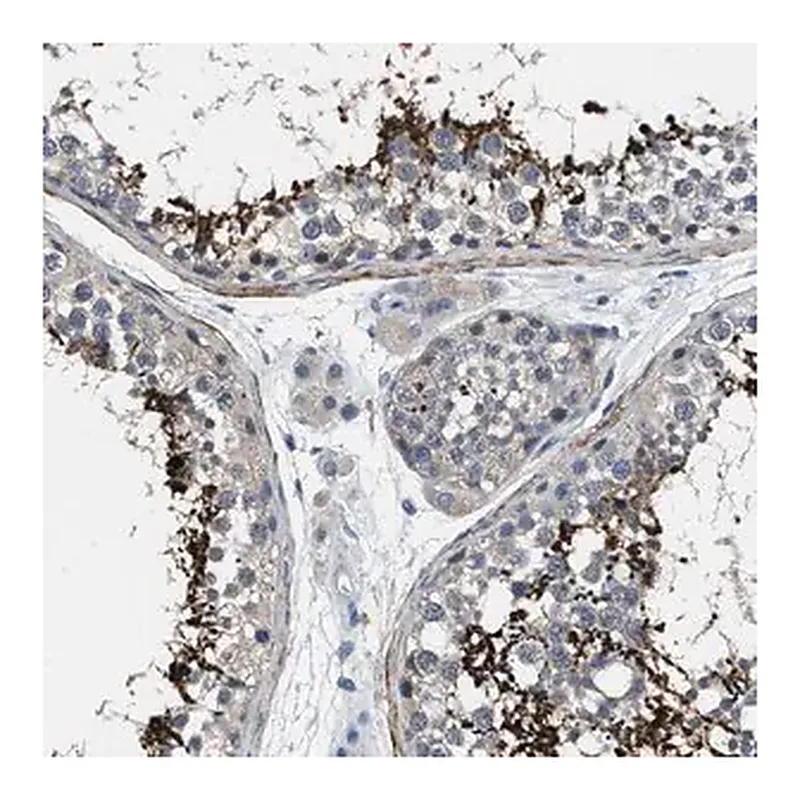 Merck Anti-DGKE antibody produced in rabbit