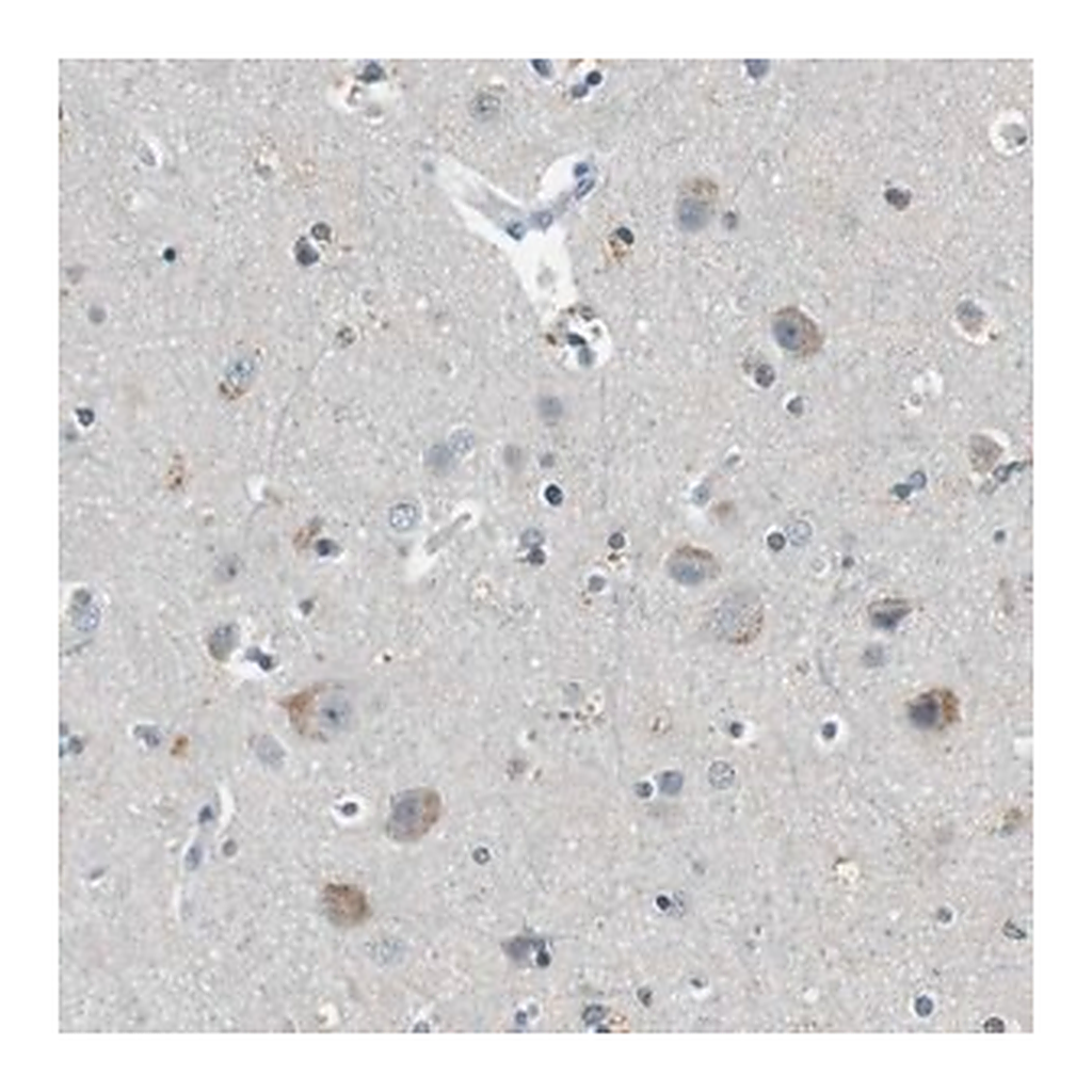 Merck Anti-CDK14 antibody produced in rabbit