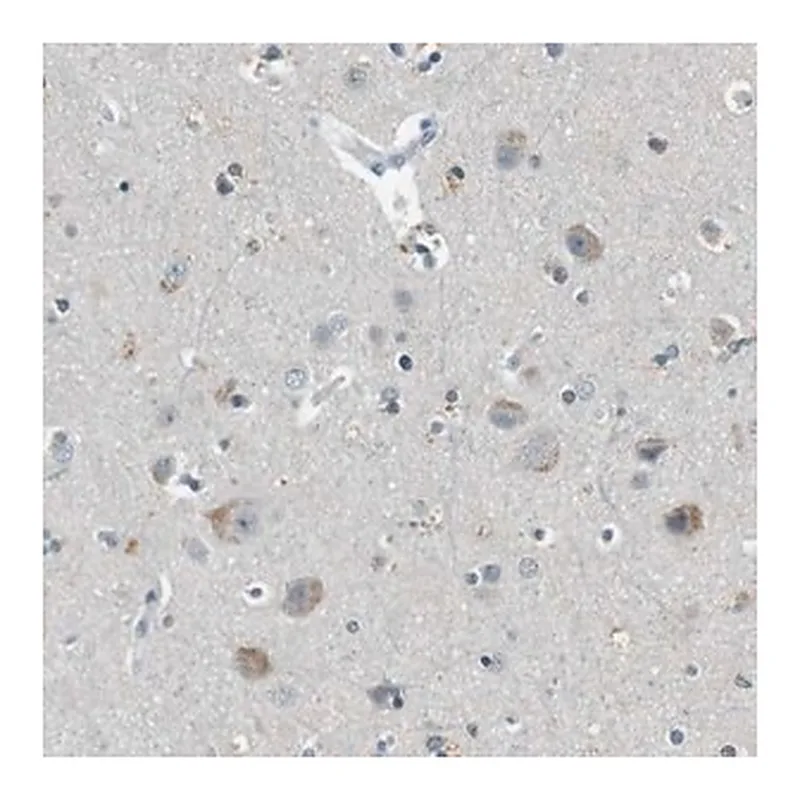 Merck Anti-CDK14 antibody produced in rabbit