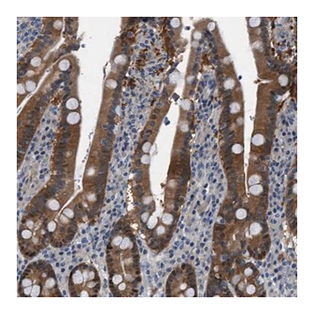 Merck Anti-TMEM45B antibody produced in rabbit