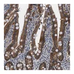 Merck Anti-TMEM45B antibody produced in rabbit