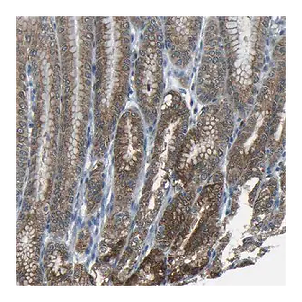 Merck Anti-ANKRD22 antibody produced in rabbit