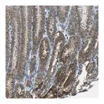 Merck Anti-ANKRD22 antibody produced in rabbit