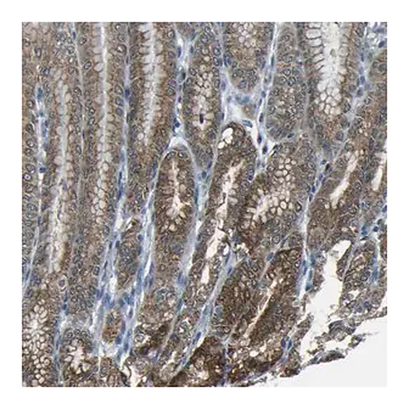 Merck Anti-ANKRD22 antibody produced in rabbit