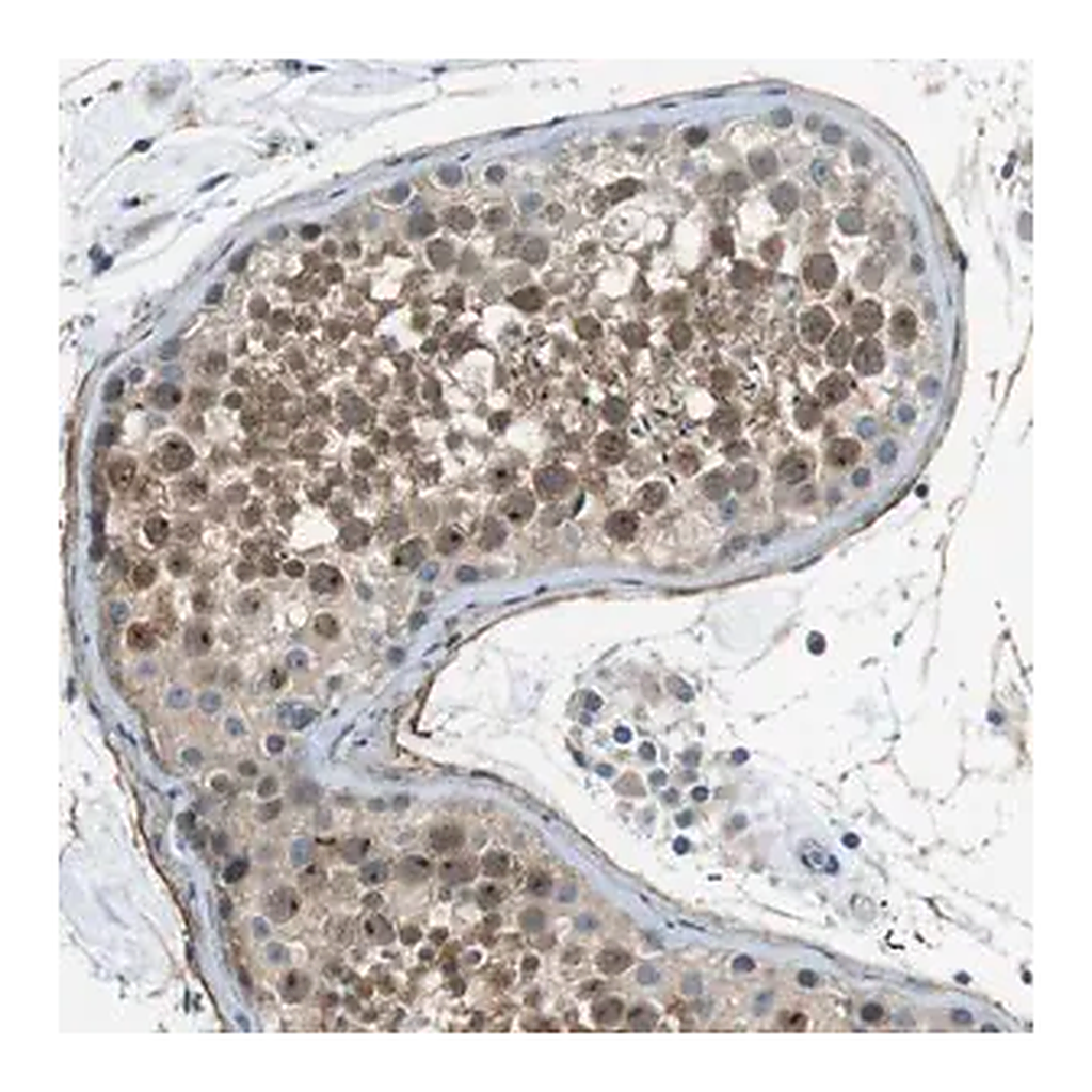 Merck Anti-ENTPD7 antibody produced in rabbit