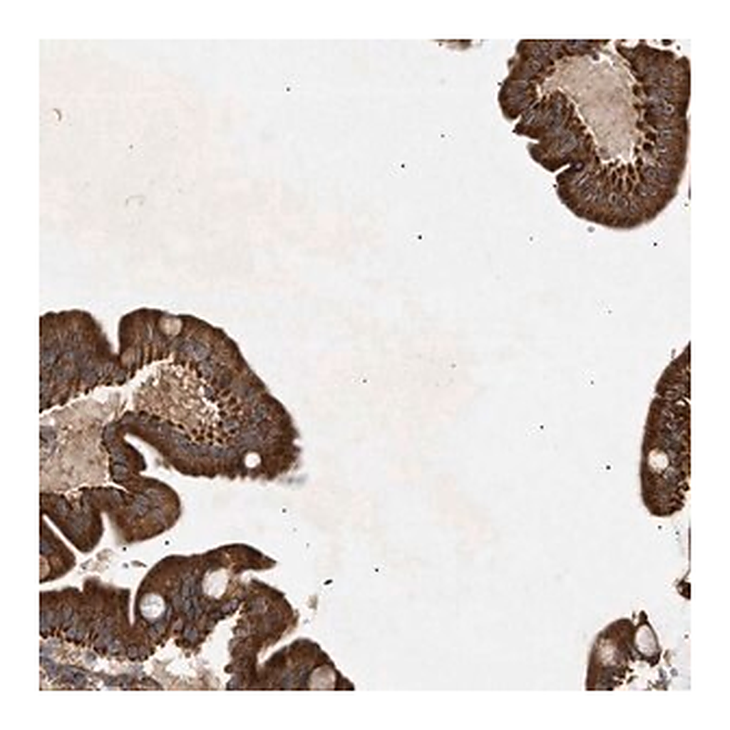 Merck Anti-MTCH1 antibody produced in rabbit