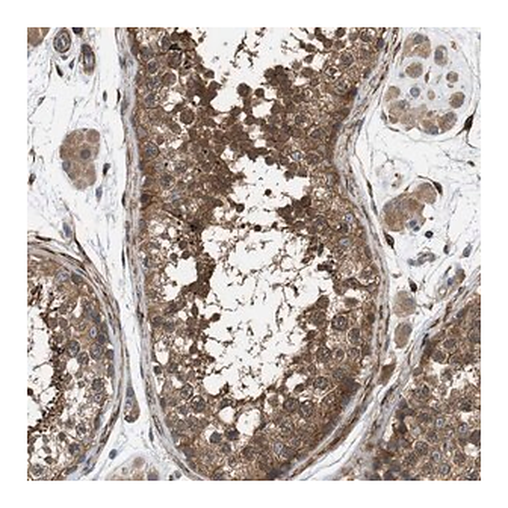 Merck Anti-CHKB antibody produced in rabbit