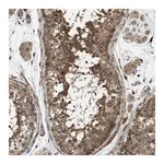 Merck Anti-CHKB antibody produced in rabbit