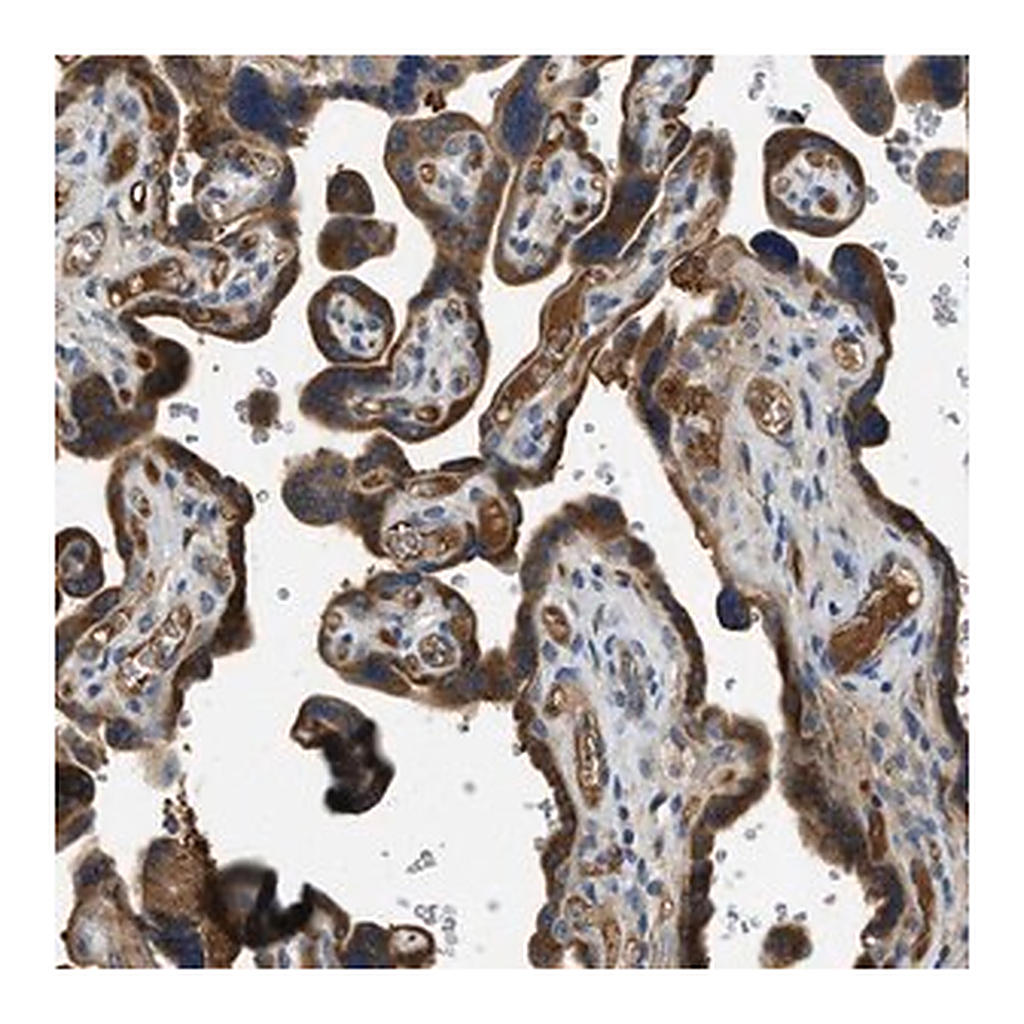 Merck Anti-RIPK2 antibody produced in rabbit