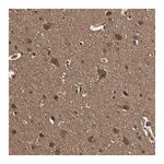 Merck Anti-YWHAE antibody produced in rabbit