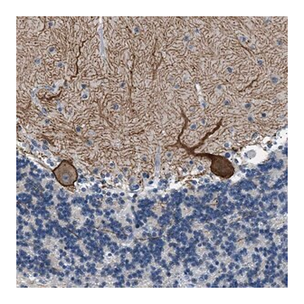 Merck Anti-KCNC3 antibody produced in rabbit