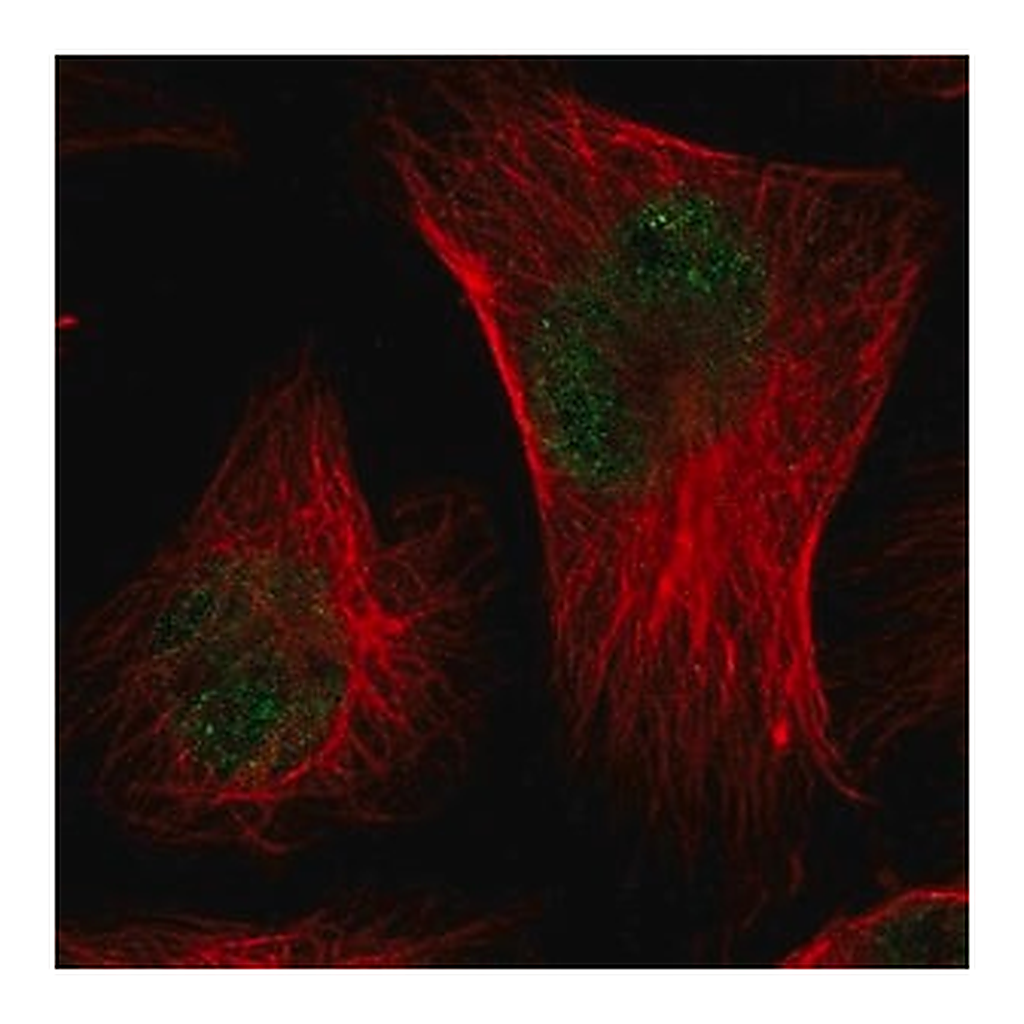 Merck Anti-CMTM3 antibody produced in rabbit