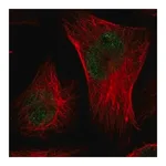 Merck Anti-CMTM3 antibody produced in rabbit