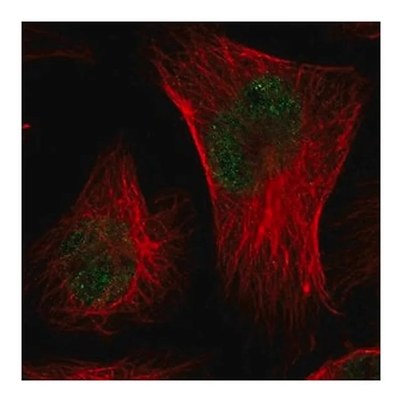 Merck Anti-CMTM3 antibody produced in rabbit