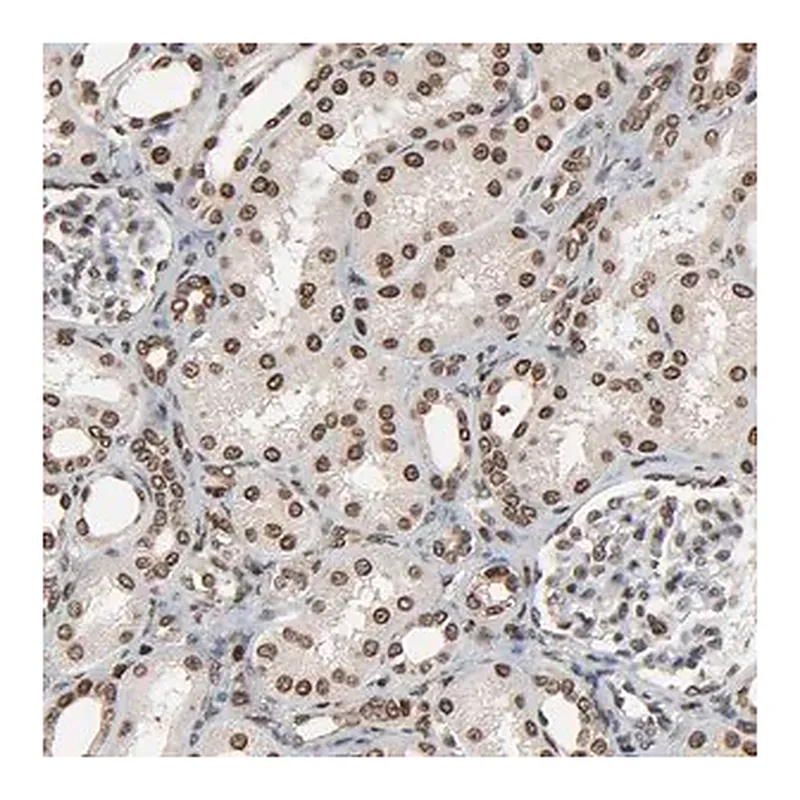 Merck Anti-RPS6KA3 antibody produced in rabbit