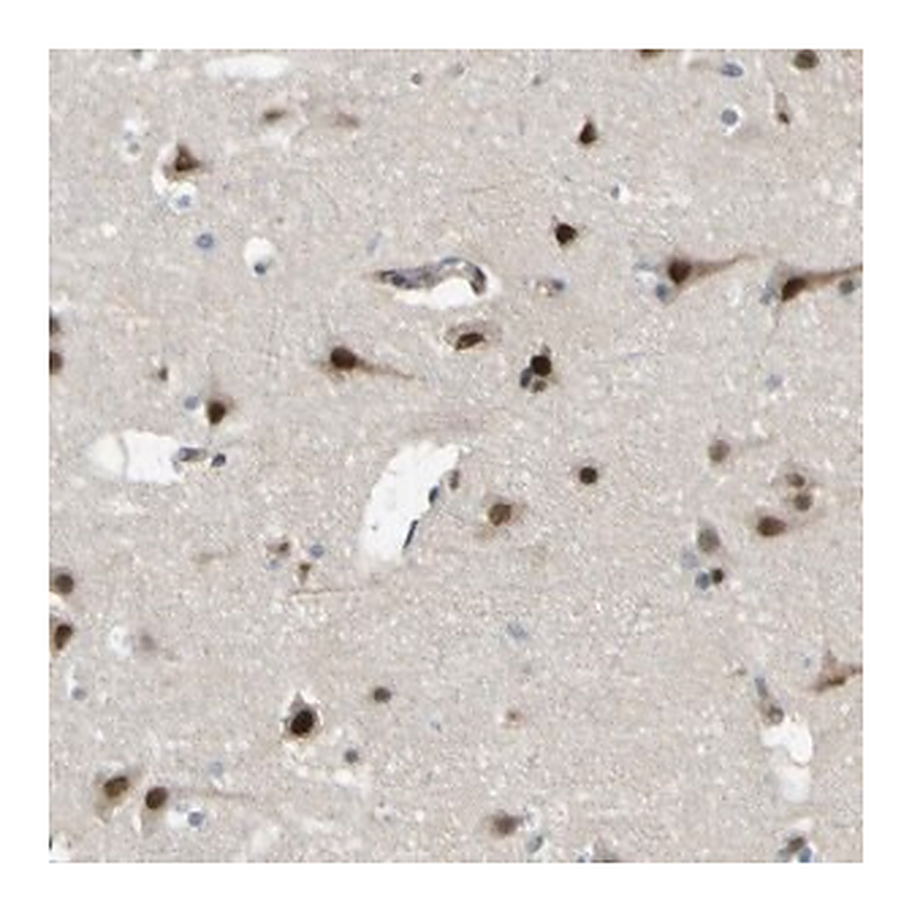Merck Anti-KDM7A antibody produced in rabbit