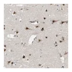 Merck Anti-KDM7A antibody produced in rabbit