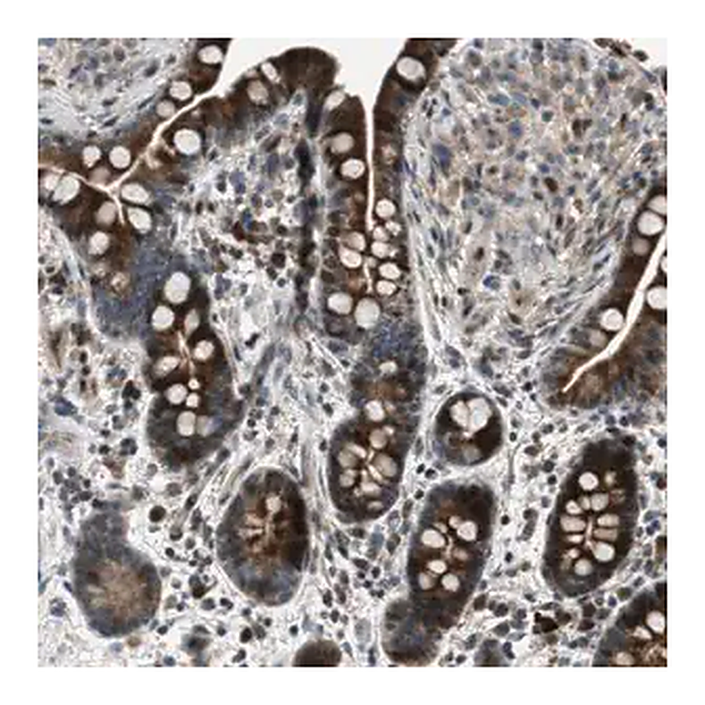 Merck Anti-CLEC2D antibody produced in rabbit