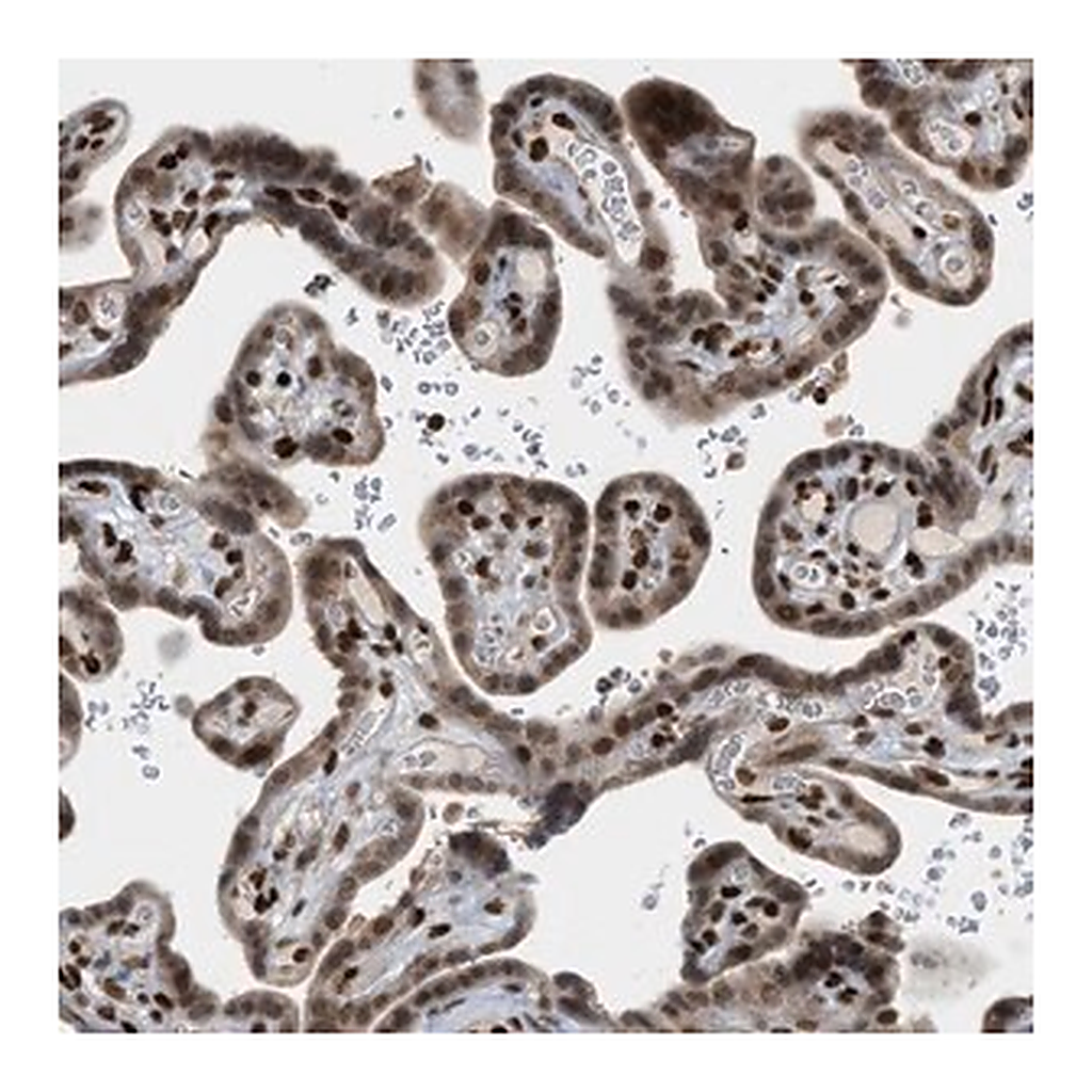 Merck Anti-ZNF22 antibody produced in rabbit
