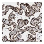 Merck Anti-ZNF22 antibody produced in rabbit
