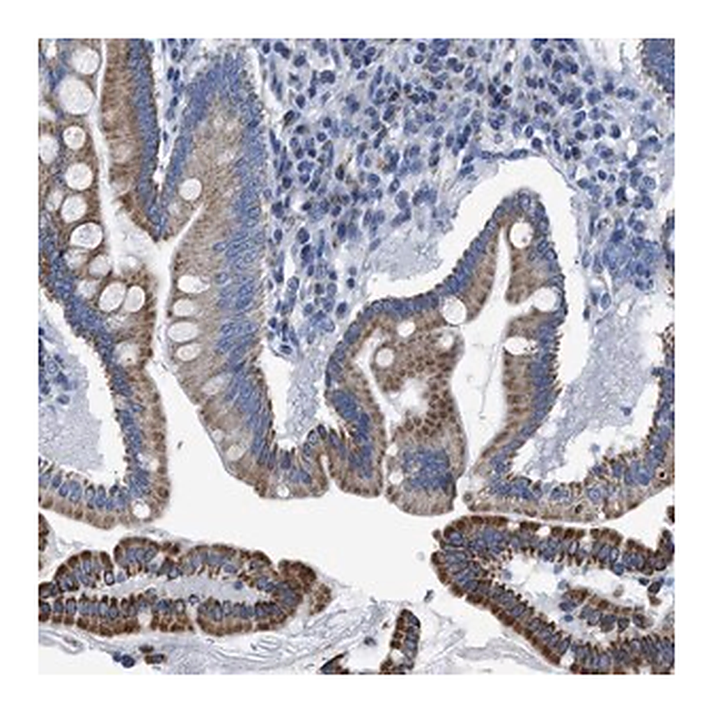 Merck Anti-ZDHHC3 antibody produced in rabbit