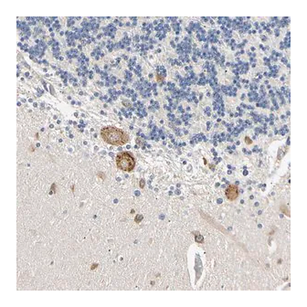 Merck Anti-RARS antibody produced in rabbit