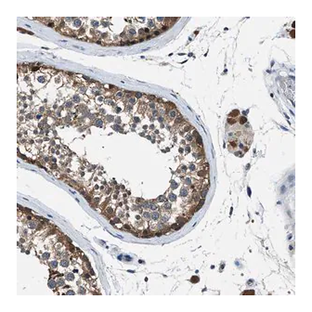 Merck Anti-ACP1 antibody produced in rabbit