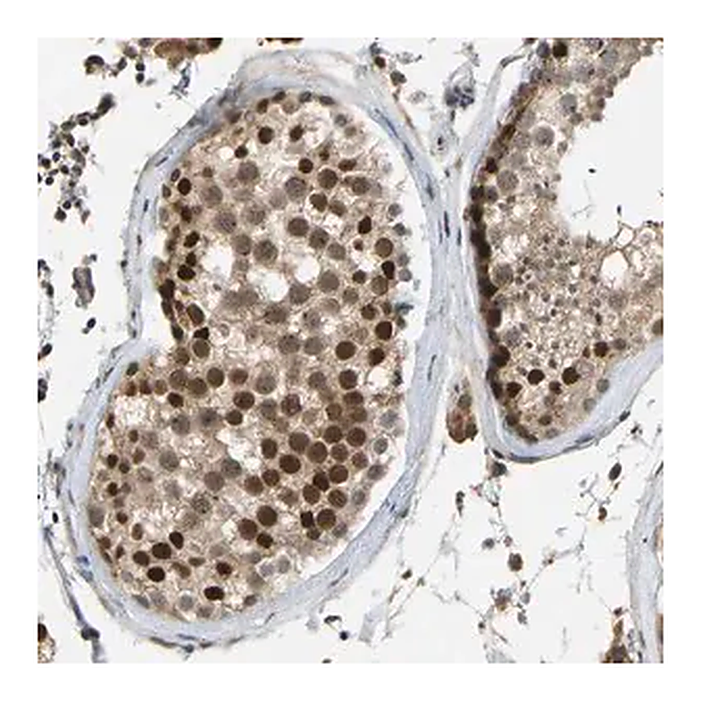 Merck Anti-ZNF251 antibody produced in rabbit