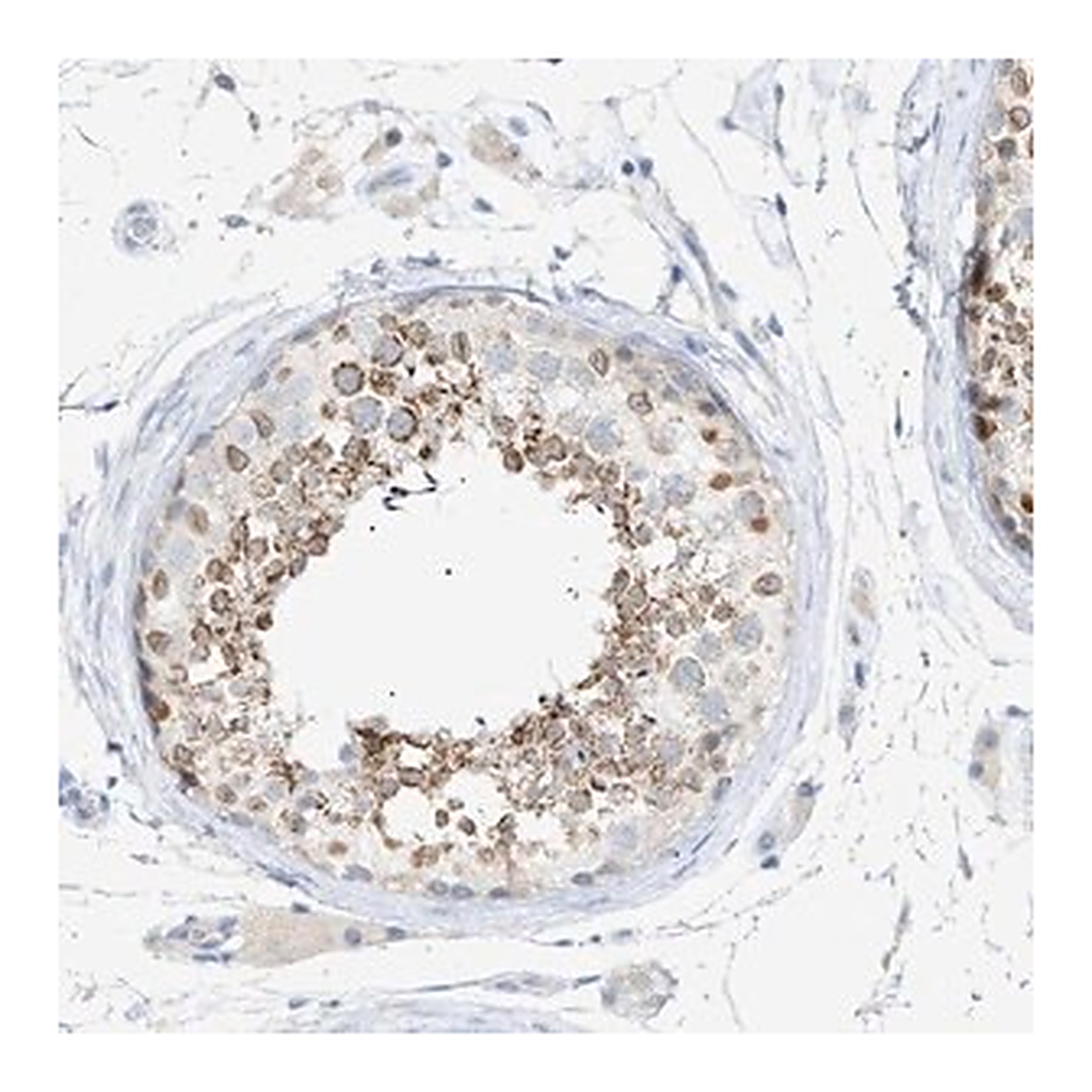 Merck Anti-SLC25A31 antibody produced in rabbit