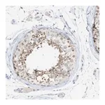 Merck Anti-SLC25A31 antibody produced in rabbit