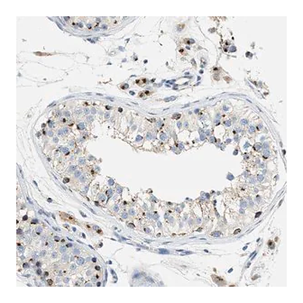 Merck Anti-ENTPD4 antibody produced in rabbit