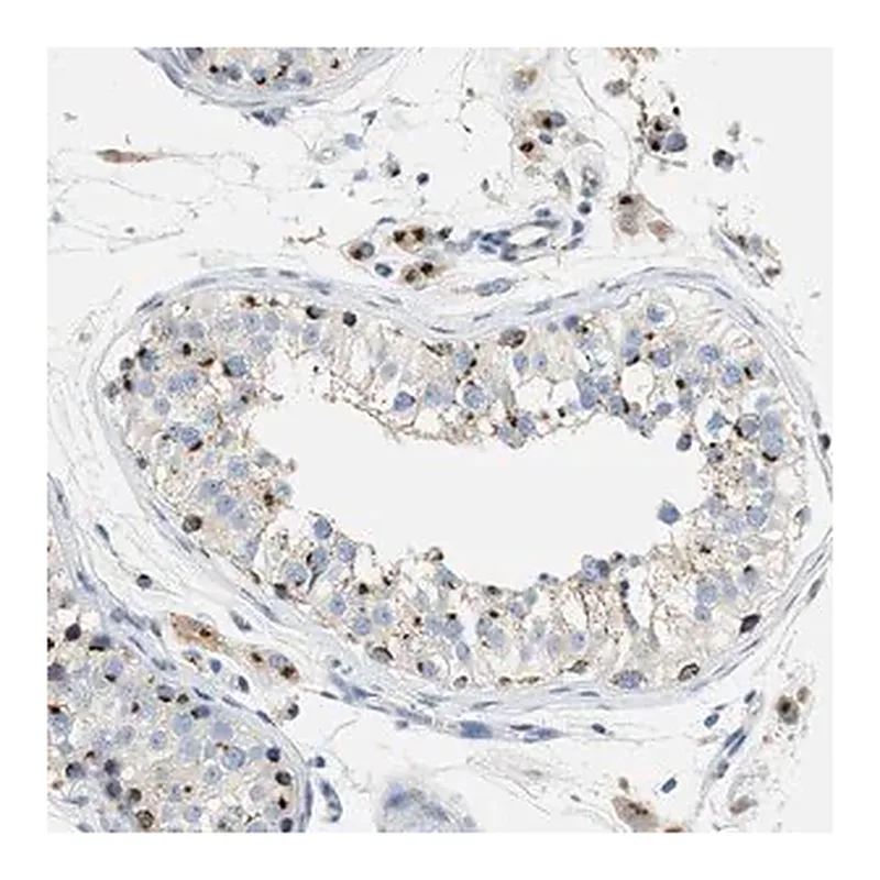 Merck Anti-ENTPD4 antibody produced in rabbit